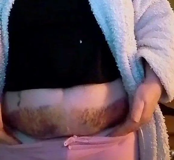 Capture vidéo des blessures d'Adele Gough après son accident de voiture